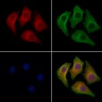 RPS16 Antibody in Immunocytochemistry (ICC/IF)