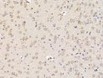 RPS16 Antibody in Immunohistochemistry (Paraffin) (IHC (P))