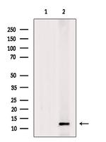 S100A6 Antibody in Western Blot (WB)