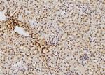 S100 Antibody in Immunohistochemistry (Paraffin) (IHC (P))