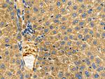 S100 Antibody in Immunohistochemistry (Paraffin) (IHC (P))