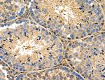 S100 Antibody in Immunohistochemistry (Paraffin) (IHC (P))