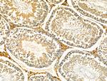 S100 Antibody in Immunohistochemistry (Paraffin) (IHC (P))