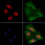 SALL1 Antibody in Immunocytochemistry (ICC/IF)