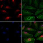 SART1 Antibody in Immunocytochemistry (ICC/IF)