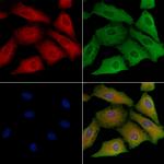 SCARF1 Antibody in Immunocytochemistry (ICC/IF)