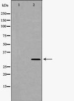 Syntenin 1 Antibody in Western Blot (WB)