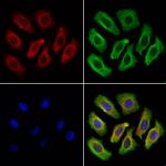 SEC61A1 Antibody in Immunocytochemistry (ICC/IF)