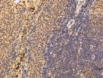 ARTS Antibody in Immunohistochemistry (Paraffin) (IHC (P))