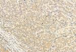 SESN2 Antibody in Immunohistochemistry (Paraffin) (IHC (P))