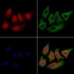 SET Antibody in Immunocytochemistry (ICC/IF)