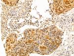 SET Antibody in Immunohistochemistry (Paraffin) (IHC (P))