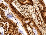 SET Antibody in Immunohistochemistry (Paraffin) (IHC (P))