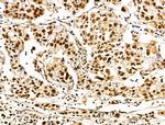 SET Antibody in Immunohistochemistry (Paraffin) (IHC (P))