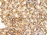 SET Antibody in Immunohistochemistry (Paraffin) (IHC (P))