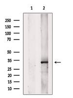 SET Antibody in Western Blot (WB)