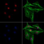 SGTA Antibody in Immunocytochemistry (ICC/IF)