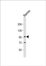 TLR2 Antibody in Western Blot (WB)