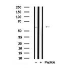 MAPKAP1 Antibody in Western Blot (WB)