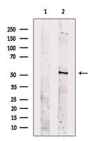 SLC16A8 Antibody in Western Blot (WB)