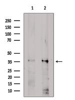 ZIP1 Antibody in Western Blot (WB)