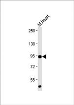 TLR2 Antibody in Western Blot (WB)