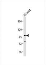 TLR2 Antibody in Western Blot (WB)