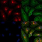 SLIT2 Antibody in Immunocytochemistry (ICC/IF)