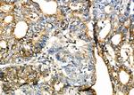 SLIT2 Antibody in Immunohistochemistry (Paraffin) (IHC (P))