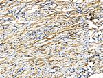 TAGLN Antibody in Immunohistochemistry (Paraffin) (IHC (P))