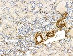 TAGLN Antibody in Immunohistochemistry (Paraffin) (IHC (P))