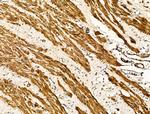 TAGLN Antibody in Immunohistochemistry (Paraffin) (IHC (P))