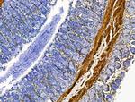 TAGLN Antibody in Immunohistochemistry (Paraffin) (IHC (P))