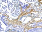 TAGLN Antibody in Immunohistochemistry (Paraffin) (IHC (P))