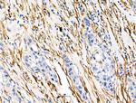 TAGLN Antibody in Immunohistochemistry (Paraffin) (IHC (P))