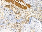 TAGLN Antibody in Immunohistochemistry (Paraffin) (IHC (P))