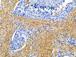 TAGLN Antibody in Immunohistochemistry (Paraffin) (IHC (P))