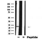 TAGLN Antibody in Western Blot (WB)