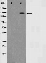 SMC1 Antibody in Western Blot (WB)