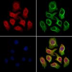 SMC1 Antibody in Immunocytochemistry (ICC/IF)