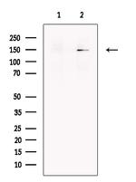 SMC1 Antibody in Western Blot (WB)