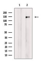 SMC2 Antibody in Western Blot (WB)