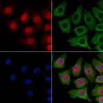 SMC5 Antibody in Immunocytochemistry (ICC/IF)