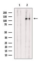 SMC5 Antibody in Western Blot (WB)