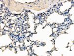 SMCHD1 Antibody in Immunohistochemistry (Paraffin) (IHC (P))