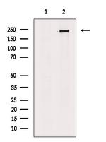 SMCHD1 Antibody in Western Blot (WB)