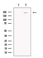 SMCHD1 Antibody in Western Blot (WB)