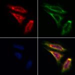 SMYD3 Antibody in Immunocytochemistry (ICC/IF)