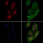 SMYD3 Antibody in Immunocytochemistry (ICC/IF)