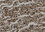 SMYD3 Antibody in Immunohistochemistry (Paraffin) (IHC (P))